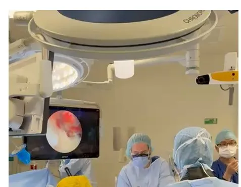 Operating theatre with overhead lights, an endoscopic display beside the table and the surgical team gowned around a draped patient